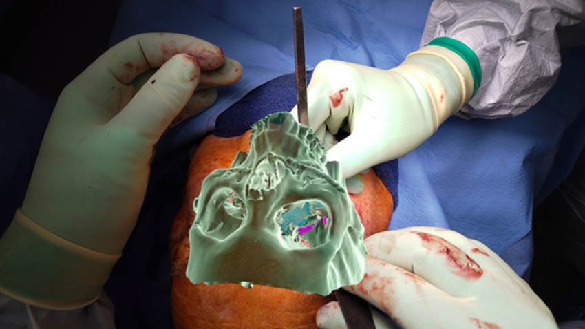 XR in the Operating Theatre