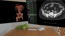 Vision Pro’s Promising Radiology Performance