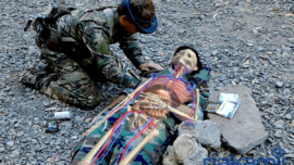 Warfighters See Through Skin