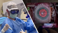 Vision Pro’s Surgery World First